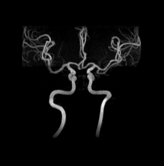 뇌 MRI 예시