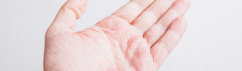 항암제피부특이반응클리닉 상단 이미지