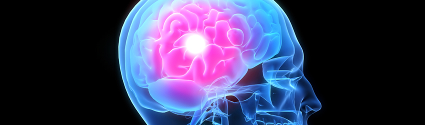 뇌종양 클리닉 상단 이미지