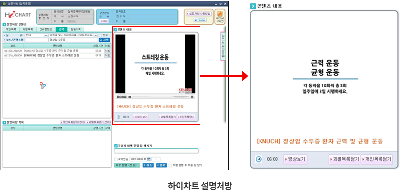 수두증 클리닉 이미지
